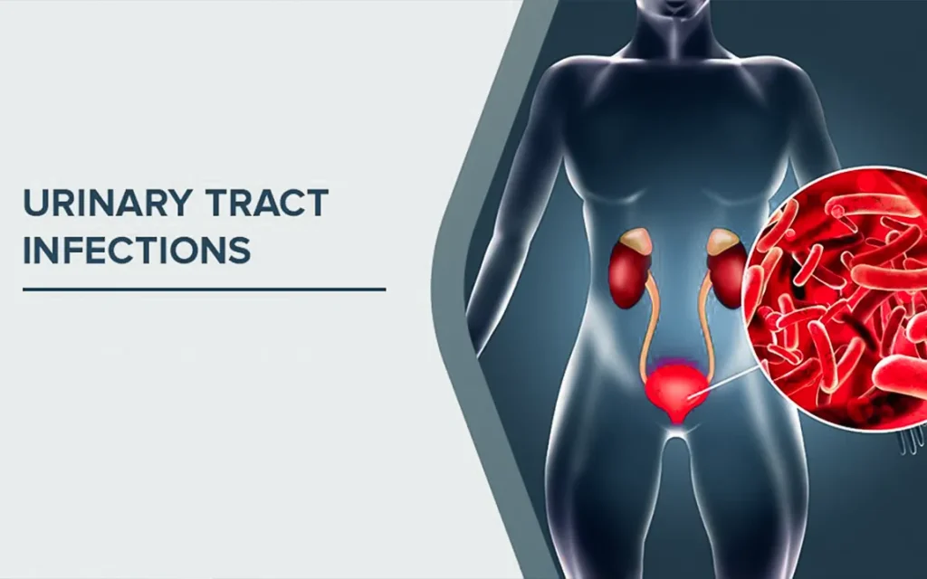 understanding-the-disparity-why-urinary-tract-infections-are-common-while-kidney-infections-remain-rare