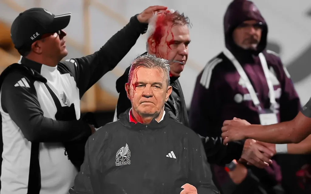 when-a-can-was-hurled-onto-the-field-from-the-spectators-mexico-soccer-manager-javier-aguirre-was-hit-leaving-his-head-covered-in-blood