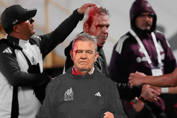 when-a-can-was-hurled-onto-the-field-from-the-spectators-mexico-soccer-manager-javier-aguirre-was-hit-leaving-his-head-covered-in-blood