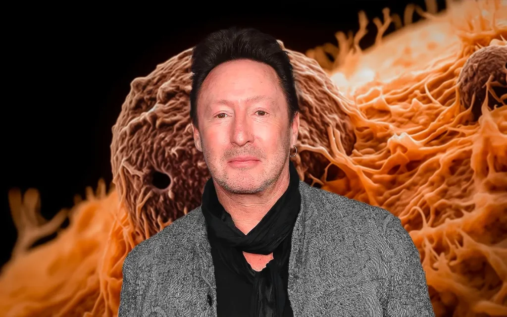 julian-lennon-has-surgery-for-a-skin-cancer-diagnosis-fingers-crossed-for-now