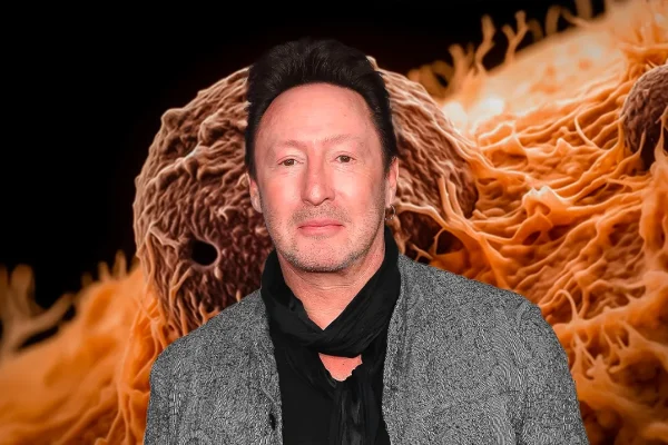 julian-lennon-has-surgery-for-a-skin-cancer-diagnosis-fingers-crossed-for-now