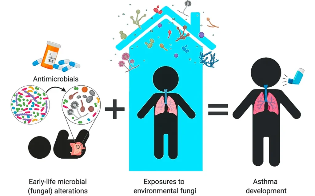 the-hidden-kingdom-of-fungi-in-allergic-rhinitis-and-asthma-a-new-dimension-how-nasal-microbes-influence-health