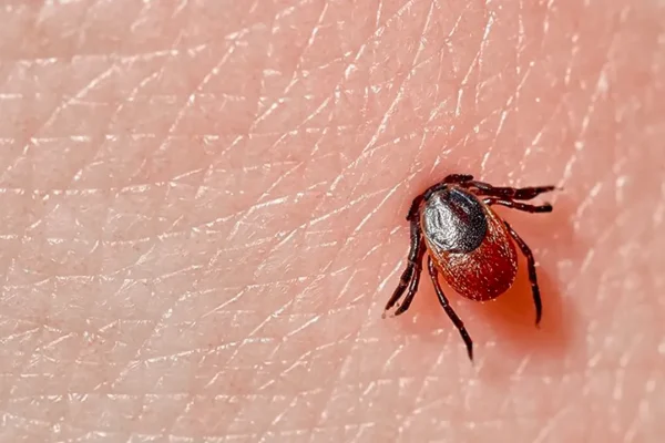 unveiling-the-physical-chemistry-of-ticks-adhesion-to-skin