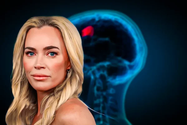 teddi-mellencamps-brave-fight-against-brain-tumors