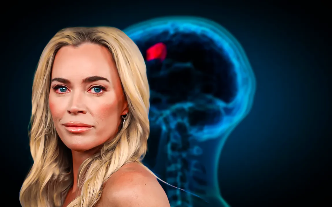 teddi-mellencamps-brave-fight-against-brain-tumors