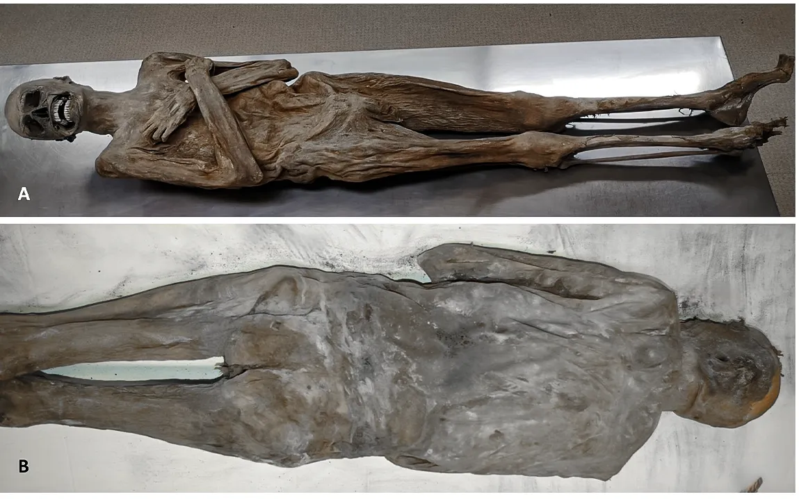 Austrian Mummy Preserved by Rare Embalming Method